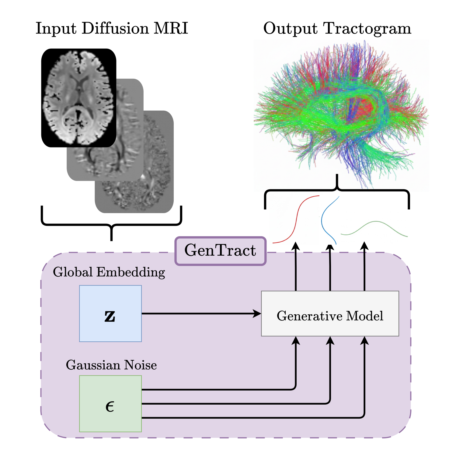 GenTract overview: a global embedding of the input diffusion MRI conditions a generative model that maps Gaussian noise to streamlines, forming the output tractogram